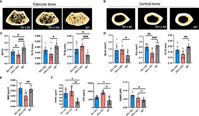 The Programmed Death-1 Pathway Counter-Regulates Inflammation-Induced Osteoclast Activity in Clinical and Experimental Settings